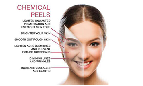 Skin Peeling