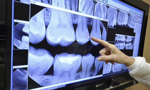 Ergonomic Dental Chairs for Patient Comfort