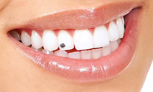Teeth Jewellery